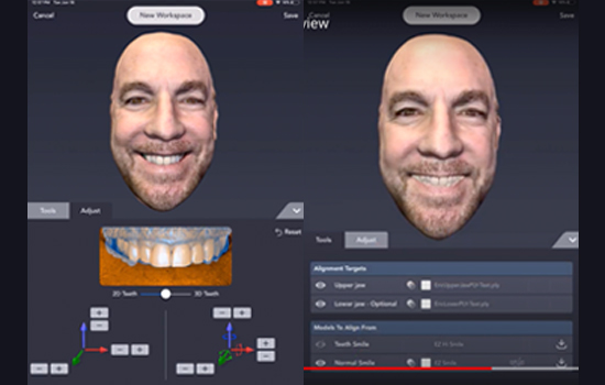 Bellus3D Dental Proのメリット